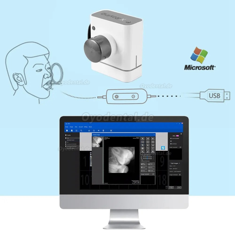Dental RVG Digitaler Röntgensensor Intraoraler Röntgensensor Intraoralsensoren